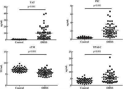 Coagulation and Fibrinolysis Biomarkers as Potential Indicators for the Diagnosis and Classification of Ovarian Hyperstimulation Syndrome